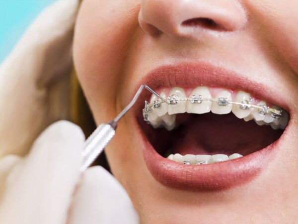 Abu Dhabi orthodontist